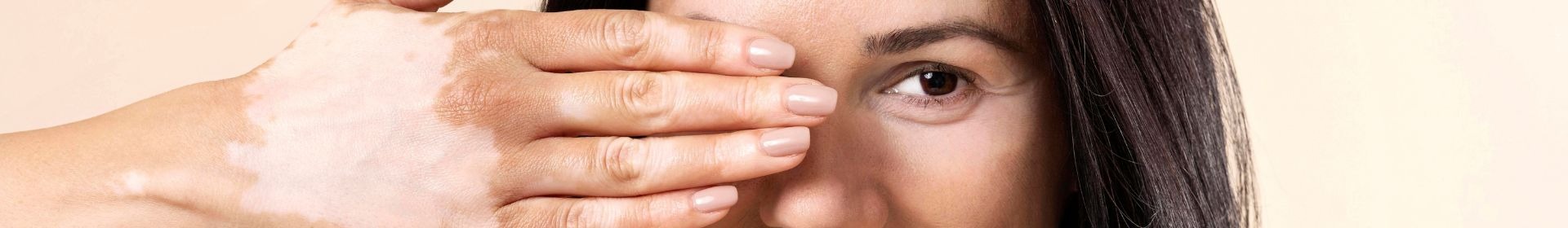 Adiós a las Manchas y la Piel Apagada: La Guía Definitiva para Reparar tu Piel Después del Verano